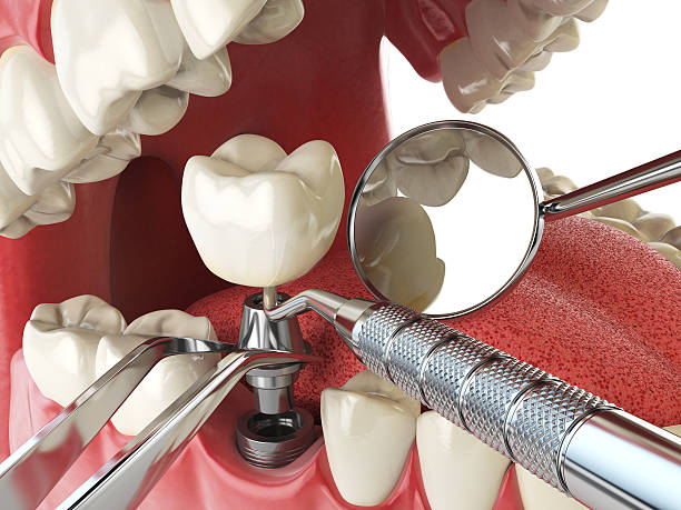 Best Knocked-Out Tooth Emergency  in Pender, NE
